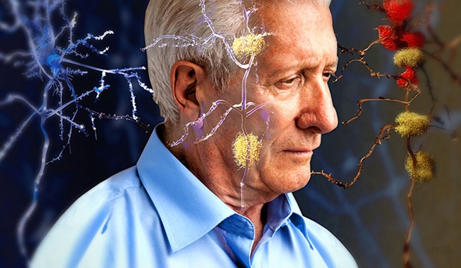 Alzheimer için yeni molekül