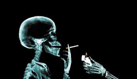 Çok sigara içmek by-pass yaşını 30 a indirdi