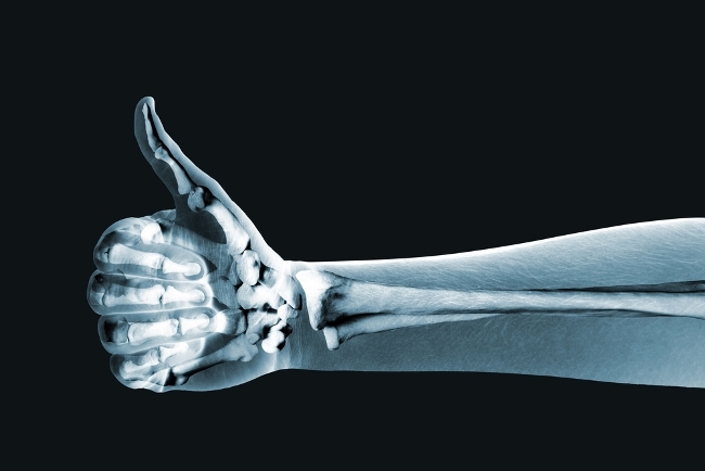 Osteoporozla beslenerek savaşın